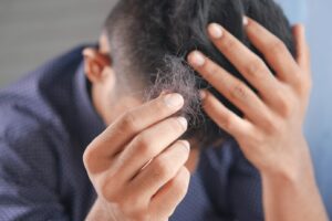 Lire la suite à propos de l’article Quels sont les avantages de la greffe de cheveux pour lutter contre la calvitie ?